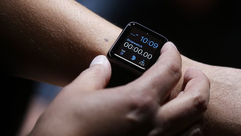 Apple Watch: Diese coole und nützliche Funktion kennen die wenigsten